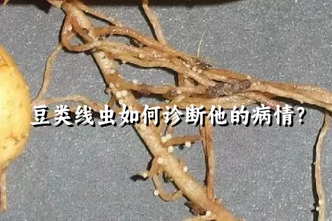 豆类线虫如何诊断他的病情？