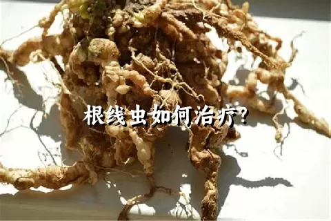 根线虫如何治疗？